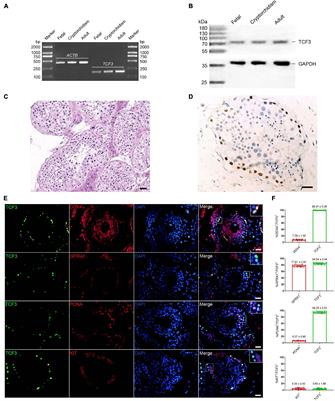 TCF3 Regulates the Proliferation and Apoptosis of Human Spermatogonial Stem Cells by Targeting PODXL